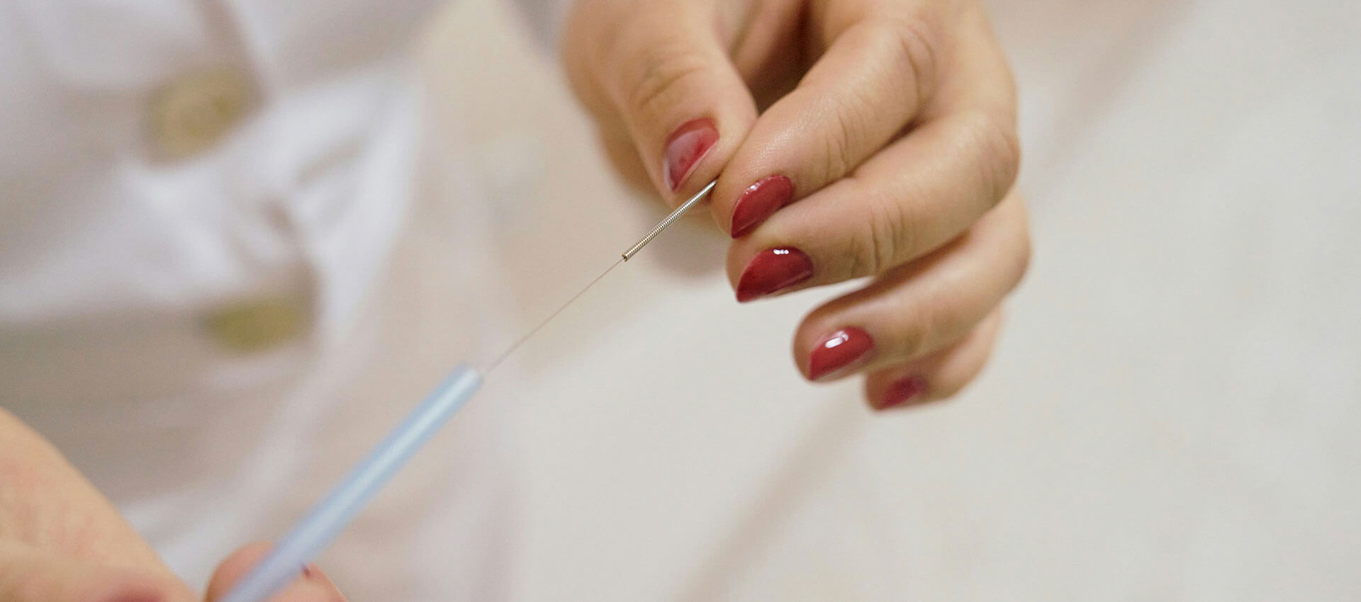 Hands with red nail polish holding a thin acupuncture needle, positioned above a blue handle, in a clinical setting.