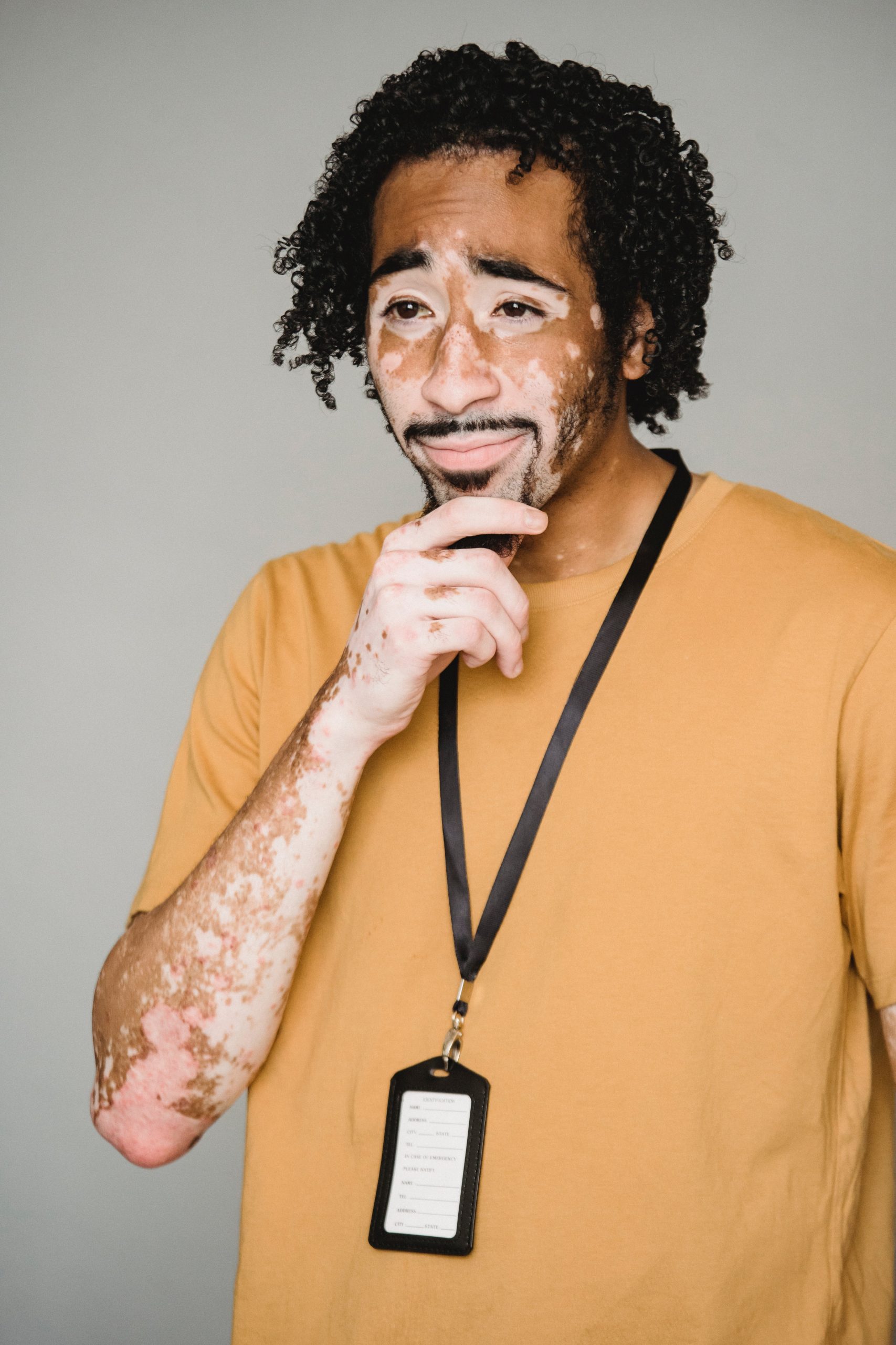 A person with vitiligo touches their chin thoughtfully, wearing a mustard shirt and a lanyard with an identification card, against a plain gray background.