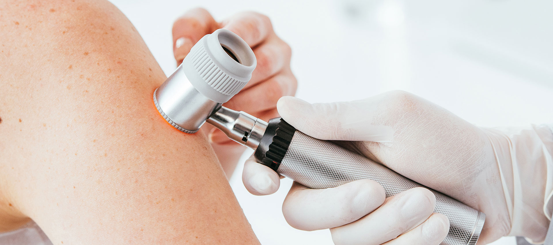 A dermatoscope is pressed against a patient's arm for a skin examination, held by a healthcare professional wearing gloves in a clinical setting.